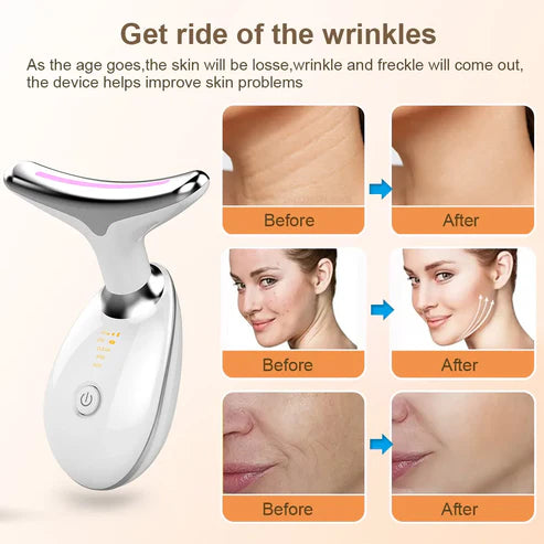 UltraRenew™ | Microcurrent face lift massager